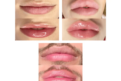 antes e depois do procedimento pump lips da Natalia Beauty